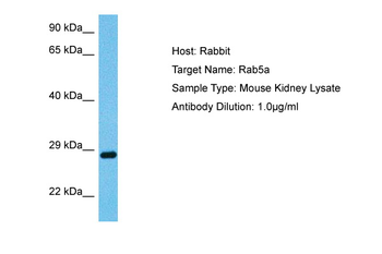 RAB5A Rabbit Polyclonal Antibody