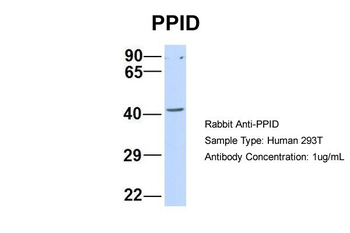 PPID Rabbit Polyclonal Antibody
