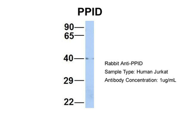 PPID Rabbit Polyclonal Antibody