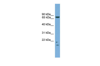 MRE11 Rabbit Polyclonal Antibody