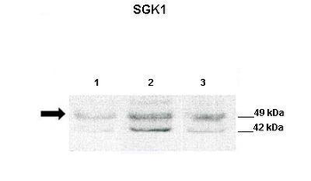 SGK1 Rabbit Polyclonal Antibody
