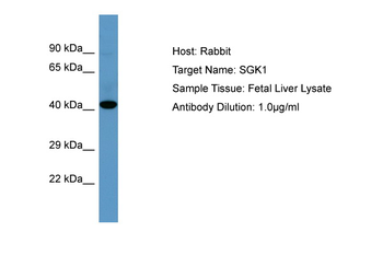 SGK1 Rabbit Polyclonal Antibody
