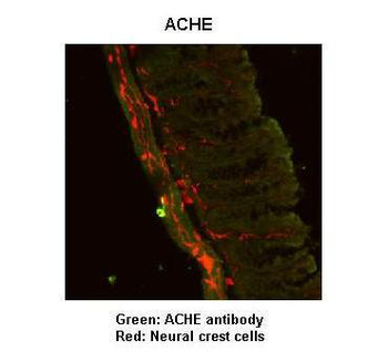 ACHE Rabbit Polyclonal Antibody