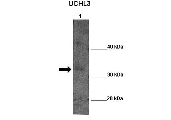UCHL5 Rabbit Polyclonal Antibody