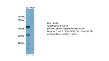 OTUD6B Rabbit Polyclonal Antibody