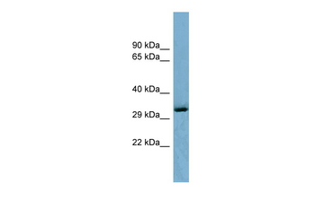 OTUD6B Rabbit Polyclonal Antibody