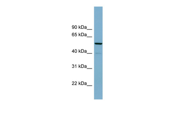 CDK5RAP1 Rabbit Polyclonal Antibody