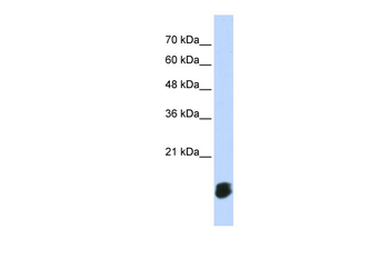 GLRX5 Rabbit Polyclonal Antibody