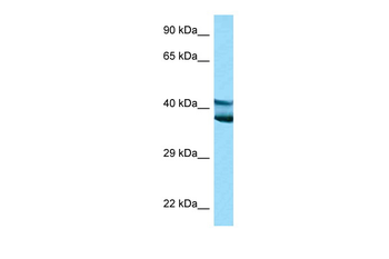 Lyar Rabbit Polyclonal Antibody