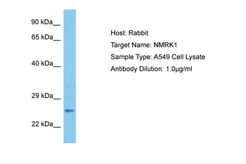C9orf95 Rabbit Polyclonal Antibody