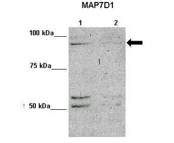 MAP7D1 Rabbit Polyclonal Antibody
