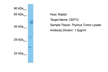 CEP72 Rabbit Polyclonal Antibody
