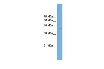 ARFGAP1 Rabbit Polyclonal Antibody