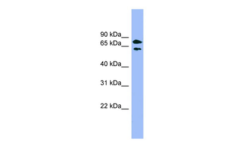 PANK4 Rabbit Polyclonal Antibody