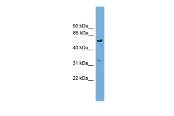 RSAD1 Rabbit Polyclonal Antibody
