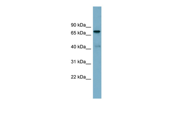 PIDD1 Rabbit Polyclonal Antibody