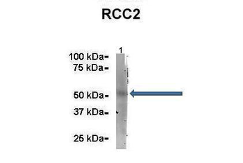 RCC2 Rabbit Polyclonal Antibody