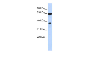 RCC2 Rabbit Polyclonal Antibody