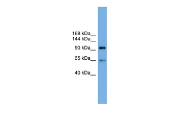 EXOC6 Rabbit Polyclonal Antibody