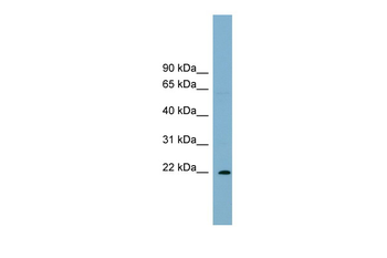 PCNP Rabbit Polyclonal Antibody
