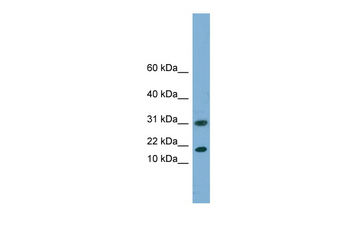 EIF5A2 Rabbit Polyclonal Antibody