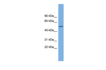 CAMK1G Rabbit Polyclonal Antibody
