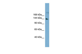 WDR35 Rabbit Polyclonal Antibody