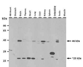 Wdfy1 Rabbit Polyclonal Antibody