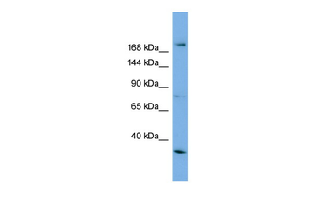 ALS2 Rabbit Polyclonal Antibody
