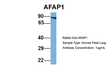 AFAP1 Rabbit Polyclonal Antibody