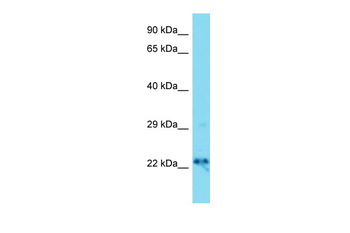 Dnajc12 Rabbit Polyclonal Antibody