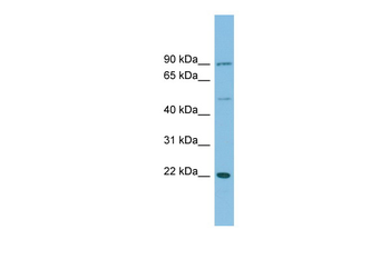 DNAJC12 Rabbit Polyclonal Antibody