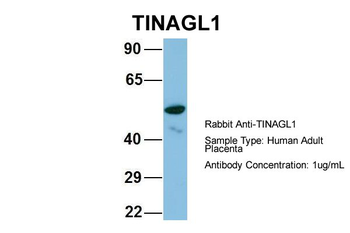 TINAGL1 Rabbit Polyclonal Antibody