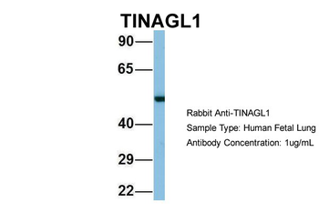 TINAGL1 Rabbit Polyclonal Antibody