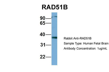 RAD51L1 Rabbit Polyclonal Antibody