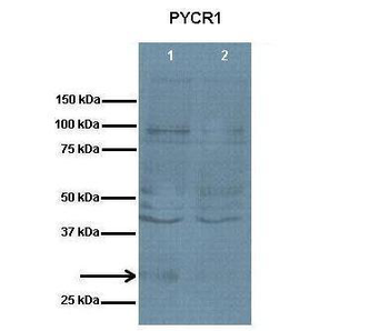 PYCR1 Rabbit Polyclonal Antibody