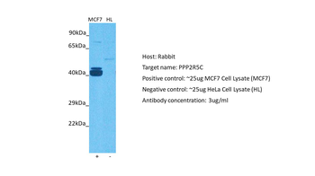 PPP2R5C Rabbit Polyclonal Antibody