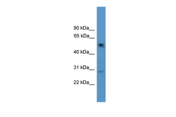 Ppp2r2c Rabbit Polyclonal Antibody