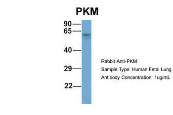 PKM2 Rabbit Polyclonal Antibody