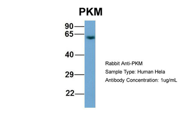 PKM2 Rabbit Polyclonal Antibody