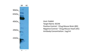 BCAN Rabbit Polyclonal Antibody