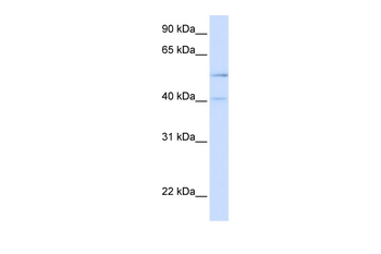 ATG4B Rabbit Polyclonal Antibody