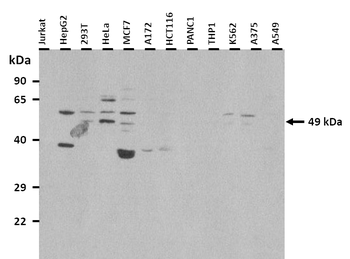 FOXA1 Rabbit Polyclonal Antibody
