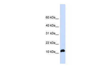 NHLH1 Rabbit Polyclonal Antibody