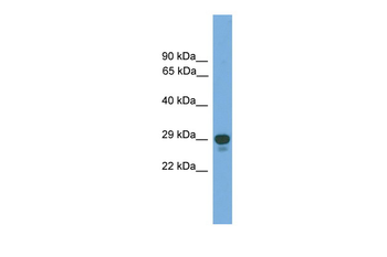 PRRX2 Rabbit Polyclonal Antibody