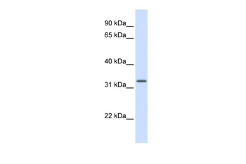 MRPS15 Rabbit Polyclonal Antibody