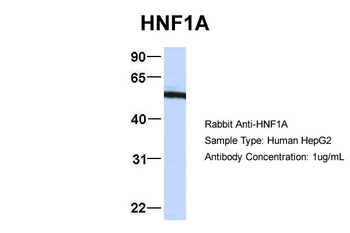HNF1A Rabbit Polyclonal Antibody