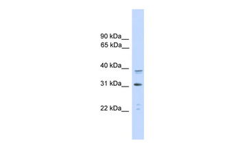 CEBPA Rabbit Polyclonal Antibody