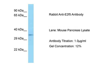 E2f5 Rabbit Polyclonal Antibody