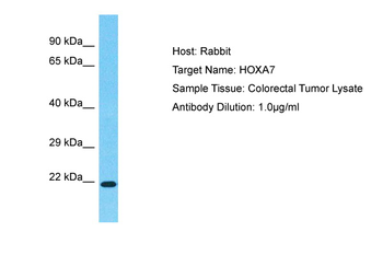 HOXA7 Rabbit Polyclonal Antibody